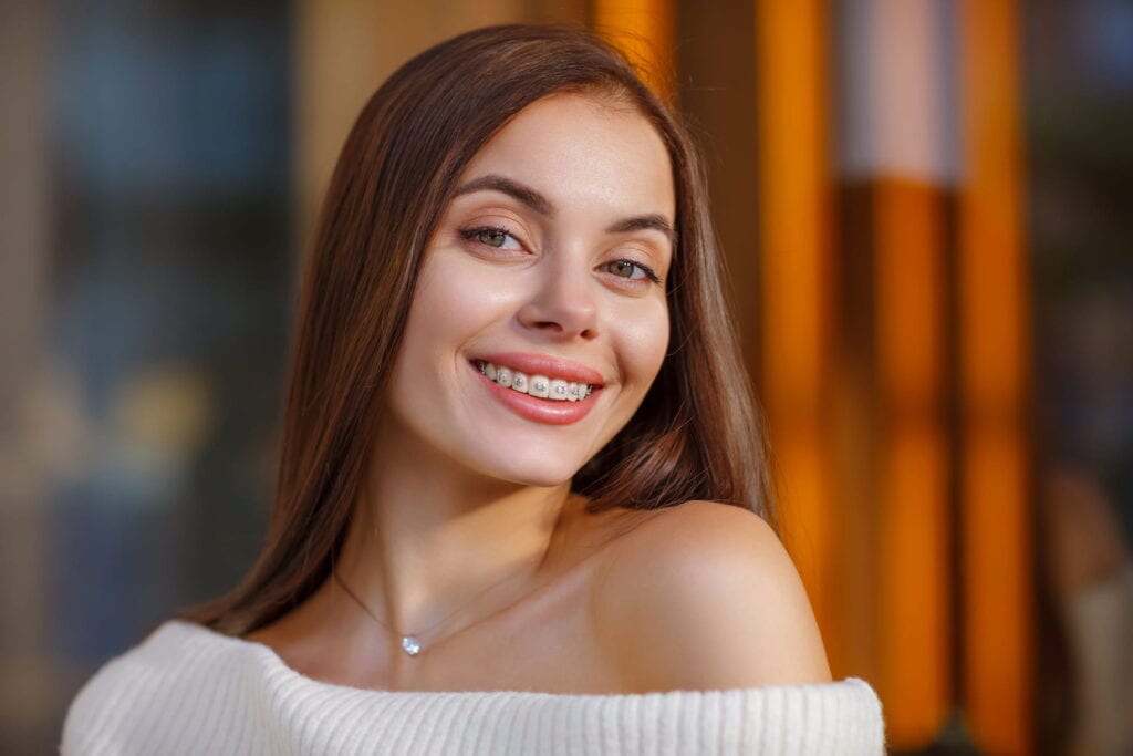 A woman shows off the gorgeous smile crafted by her braces.